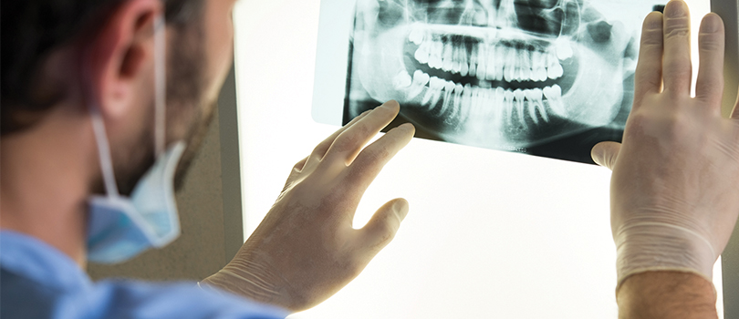Dental x-ray